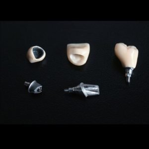 porcelain crown
